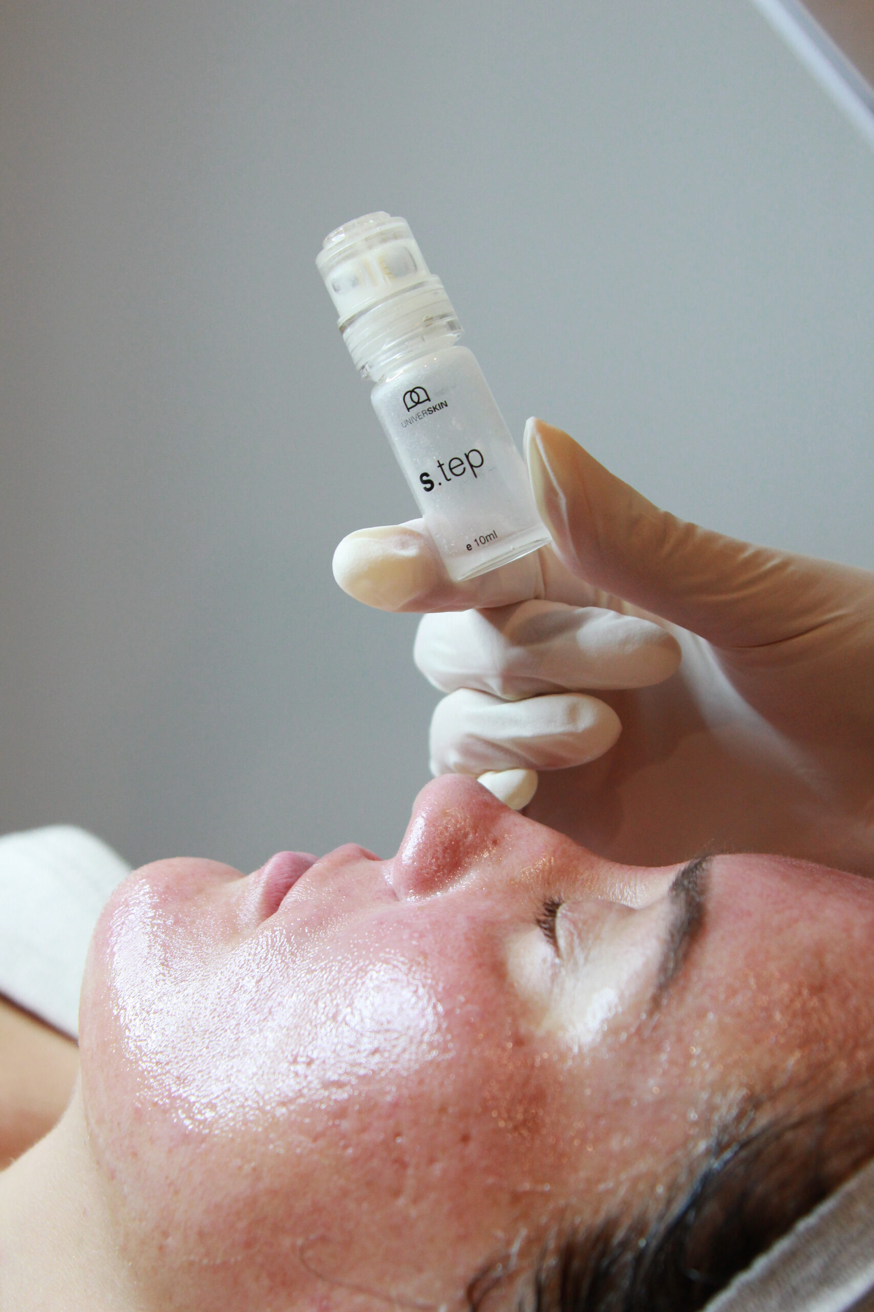 AviClear device