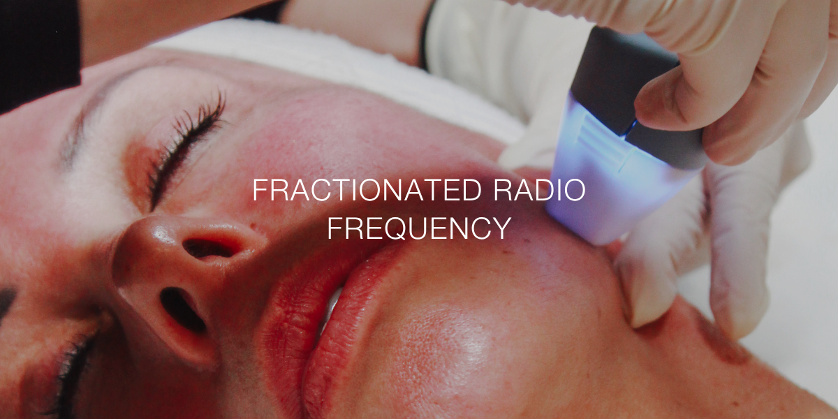 Fractionated Radio Frequency treatment at Flawless Rejuvenation